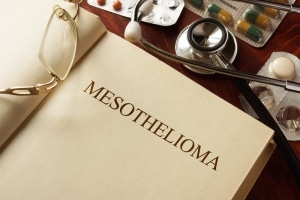 Mesothelioma Patients Should Heed the Advice of their Doctor and Asbestos Cancer Attorney