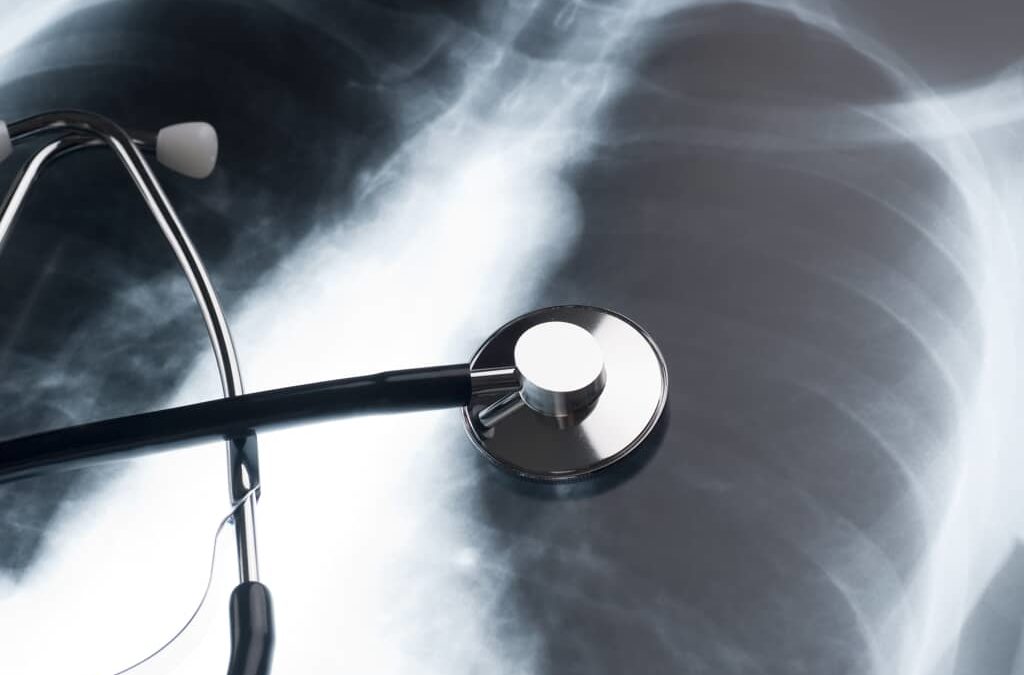 How Soon After Asbestos Exposure Should I See a Doctor?