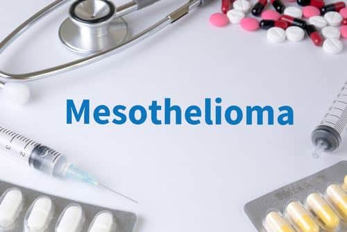 What Are the Treatment Options for Mesothelioma?