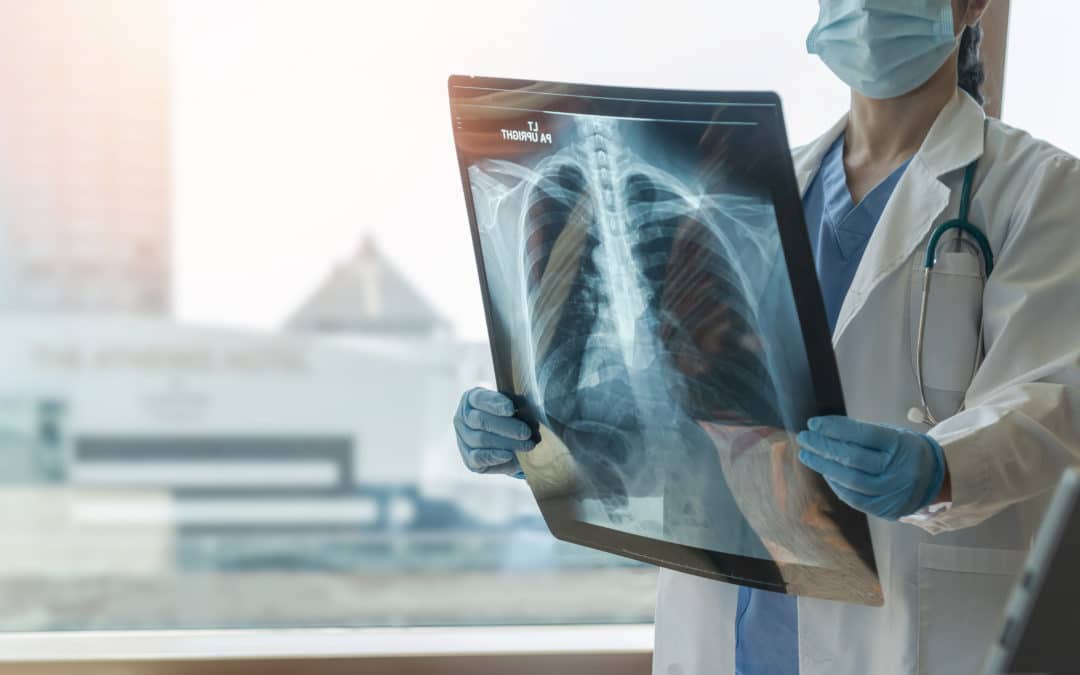 Understanding the Four Types of Mesothelioma